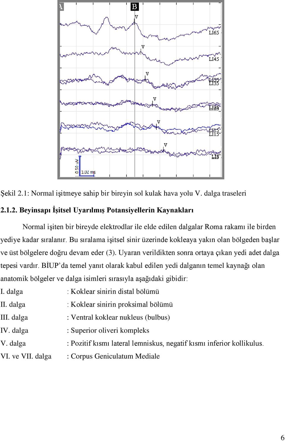 BİUP da temel yanıt olarak kabul edilen yedi dalganın temel kaynağı olan anatomik bölgeler ve dalga isimleri sırasıyla aşağıdaki gibidir: I. dalga : Koklear sinirin distal bölümü II.