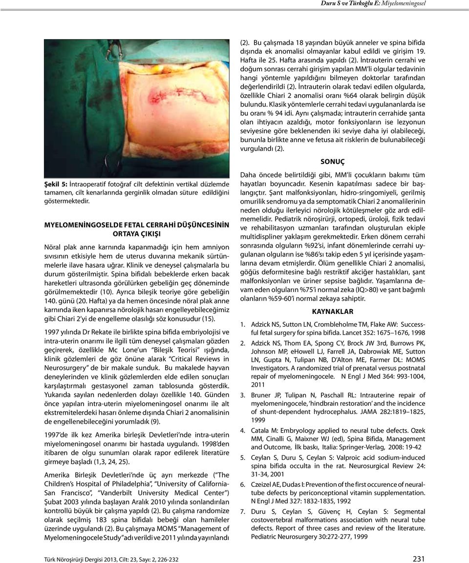 İntrauterin olarak tedavi edilen olgularda, özellikle Chiari 2 anomalisi oranı %64 olarak belirgin düşük bulundu. Klasik yöntemlerle cerrahi tedavi uygulananlarda ise bu oranı % 94 idi.