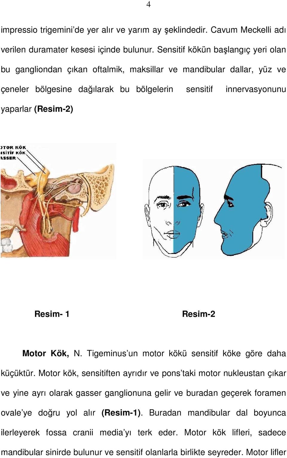 (Resim-2) Resim- 1 Resim-2 Motor Kök, N. Tigeminus un motor kökü sensitif köke göre daha küçüktür.