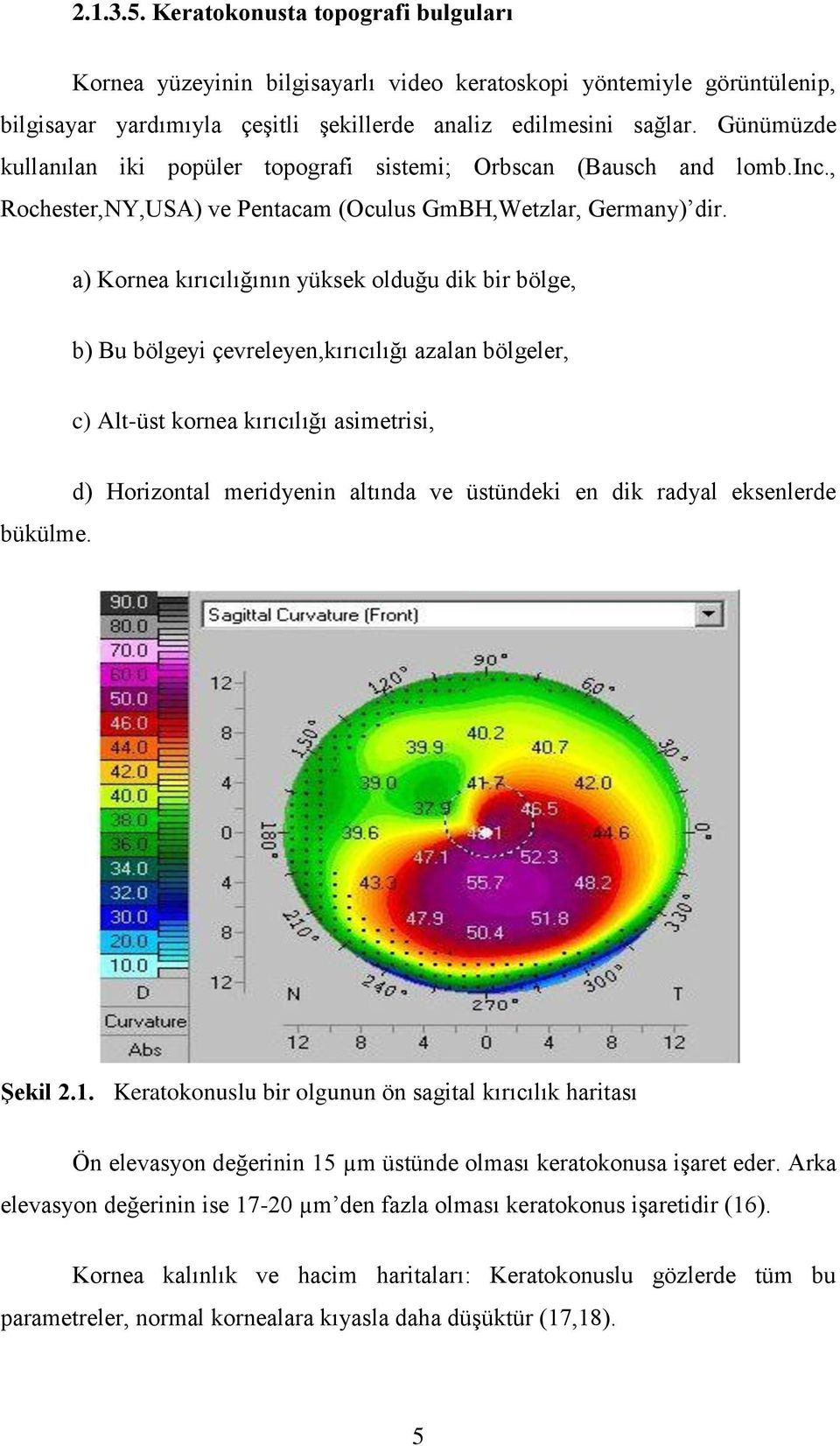 a) Kornea kırıcılığının yüksek olduğu dik bir bölge, b) Bu bölgeyi çevreleyen,kırıcılığı azalan bölgeler, c) Alt-üst kornea kırıcılığı asimetrisi, bükülme.