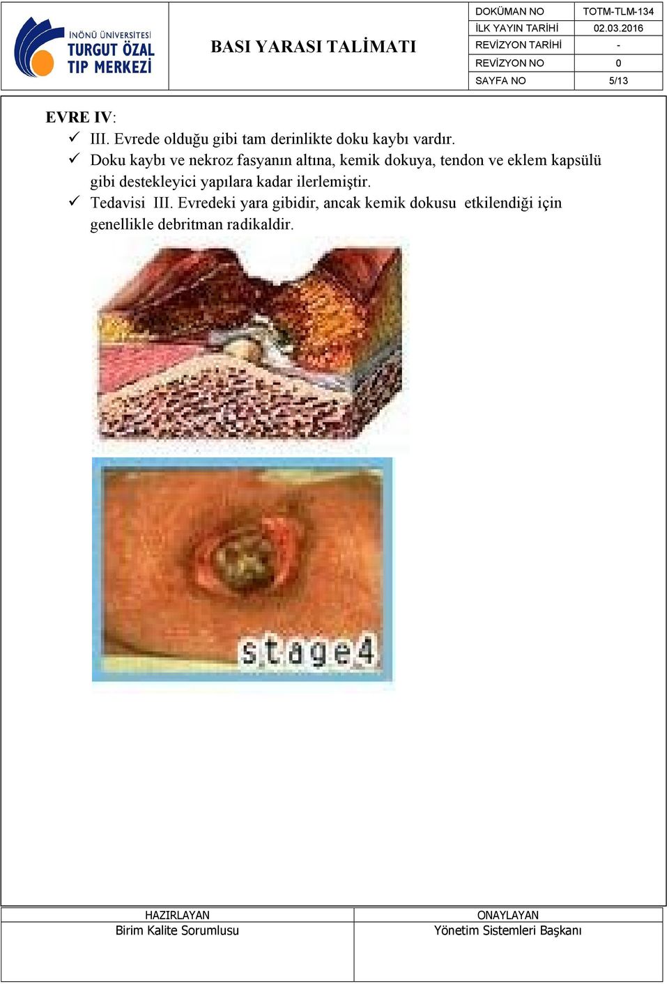 Doku kaybı ve nekroz fasyanın altına, kemik dokuya, tendon ve eklem kapsülü