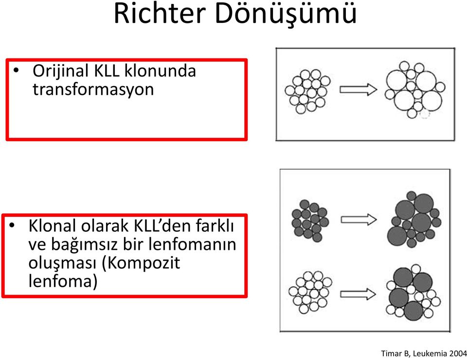 farklı ve bağımsız bir lenfomanın