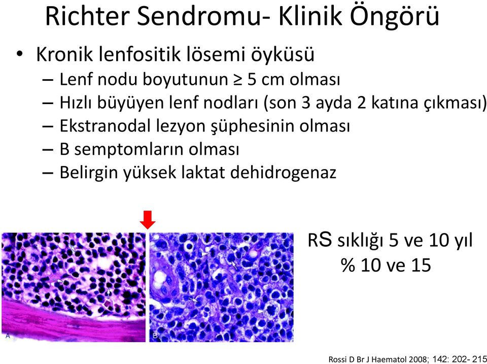 Ekstranodal lezyon şüphesinin olması B semptomların olması Belirgin yüksek