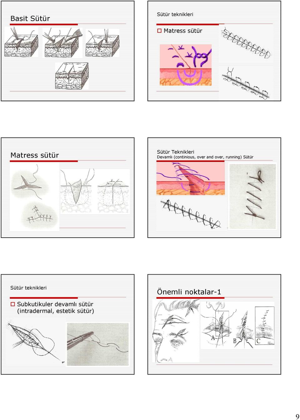 over, running) Sütür Sütür teknikleri Önemli