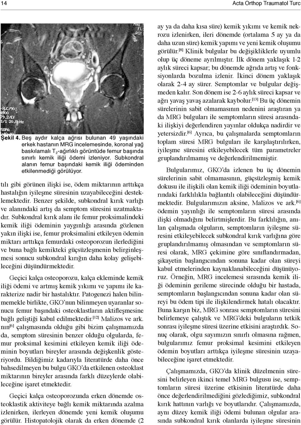 Subkondral alanın femur başındaki kemik iliği ödeminden etkilenmediği görülüyor. tılı gibi görünen ilişki ise, ödem miktarının arttıkça hastalığın iyileşme süresinin uzayabileceğini desteklemektedir.