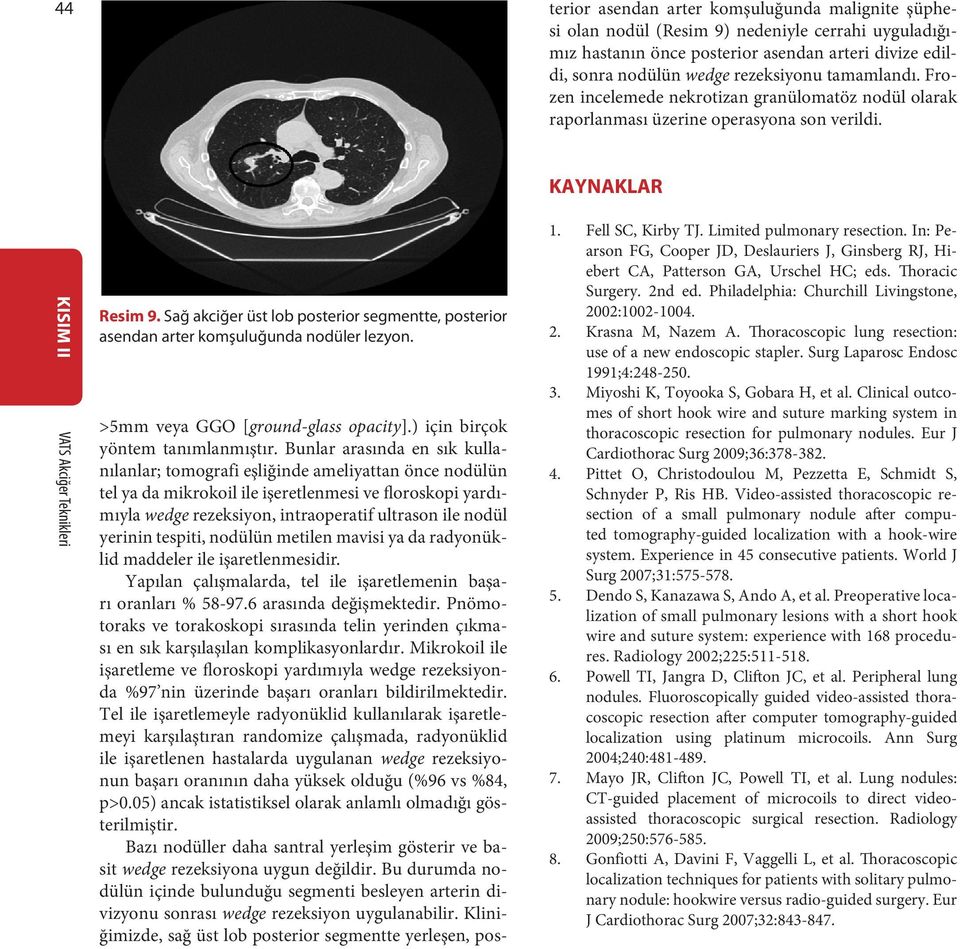 Sağ akciğer üst lob posterior segmentte, posterior asendan arter komşuluğunda nodüler lezyon. >5mm veya GGO [ground-glass opacity].) için birçok yöntem tanımlanmıştır.