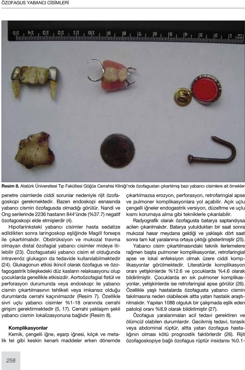 Bazen endoskopi esnasında yabancı cismin özofagusda olmadığı görülür. Nandi ve Ong serilerinde 2236 hastanın 844 ünde (%37.7) negatif özofagoskopi elde etmişlerdir (4).