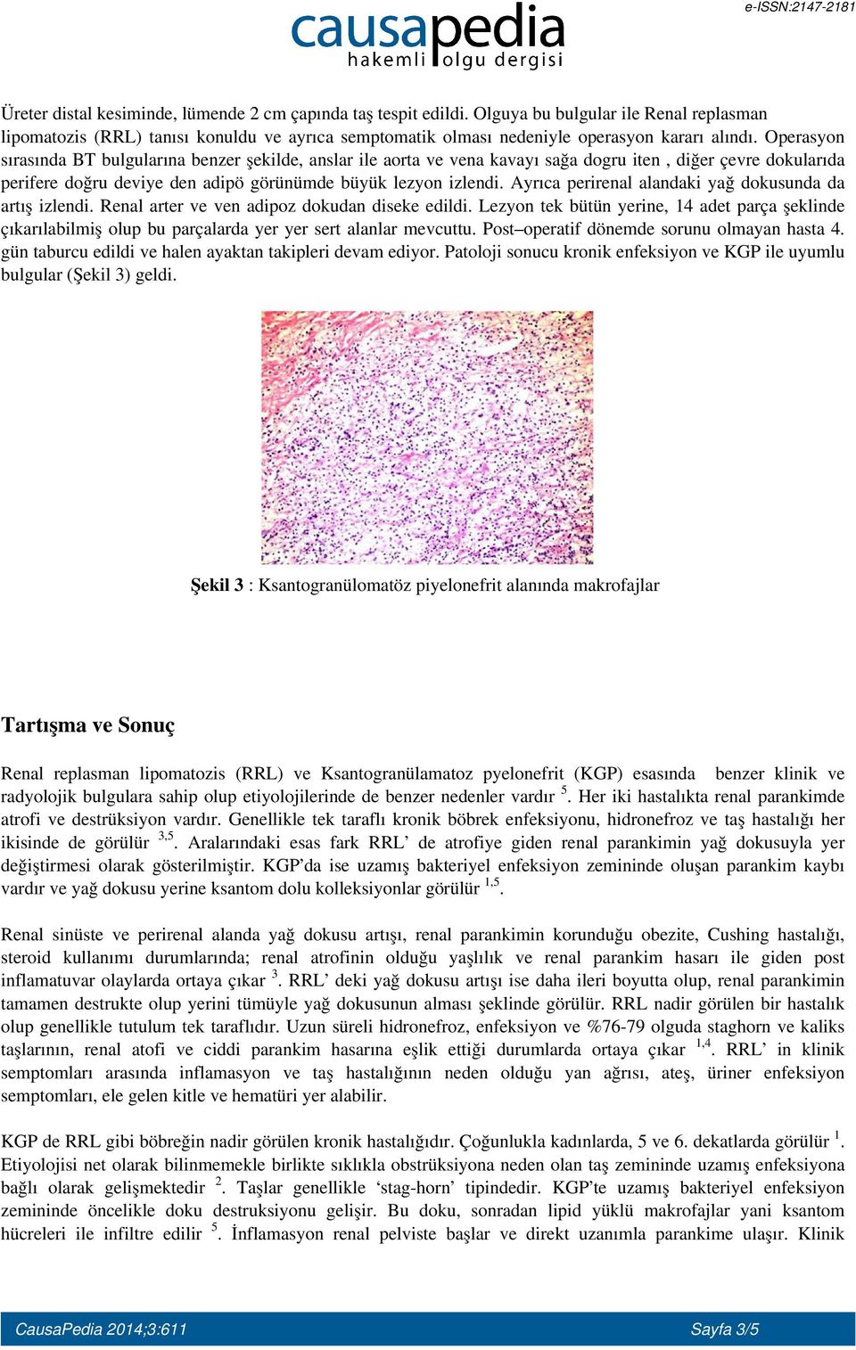 Ayrıca perirenal alandaki yağ dokusunda da artış izlendi. Renal arter ve ven adipoz dokudan diseke edildi.