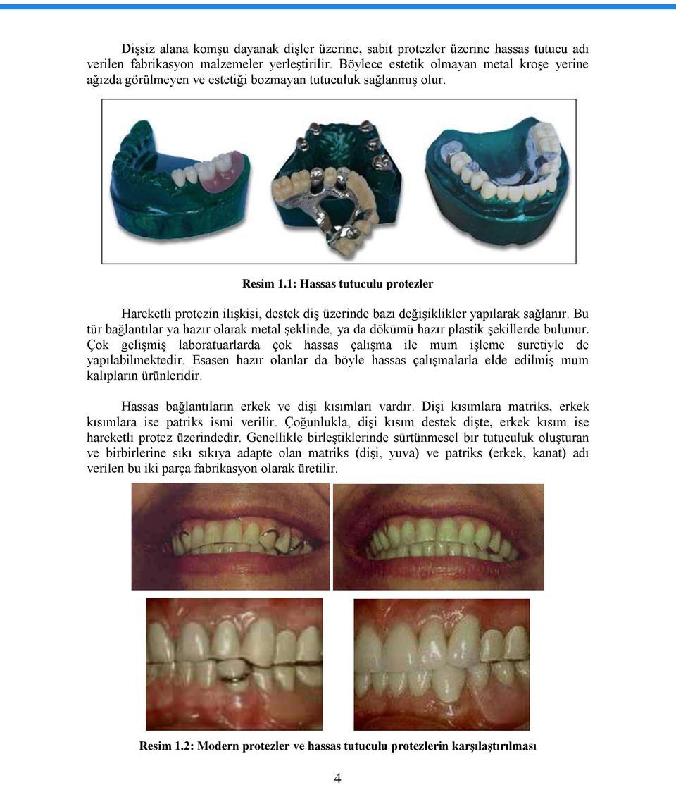1: Hassas tutuculu protezler Hareketli protezin iliģkisi, destek diģ üzerinde bazı değiģiklikler yapılarak sağlanır.