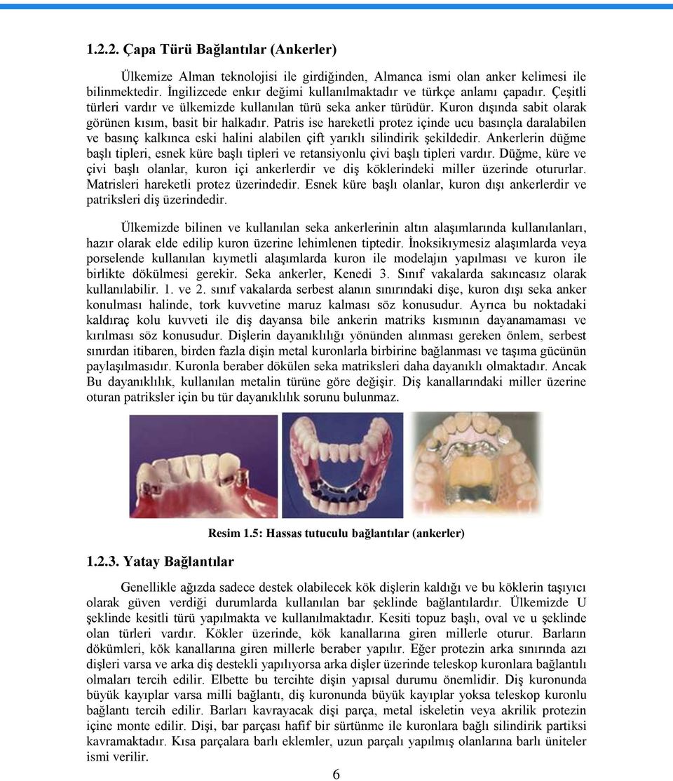 Kuron dıģında sabit olarak görünen kısım, basit bir halkadır. Patris ise hareketli protez içinde ucu basınçla daralabilen ve basınç kalkınca eski halini alabilen çift yarıklı silindirik Ģekildedir.