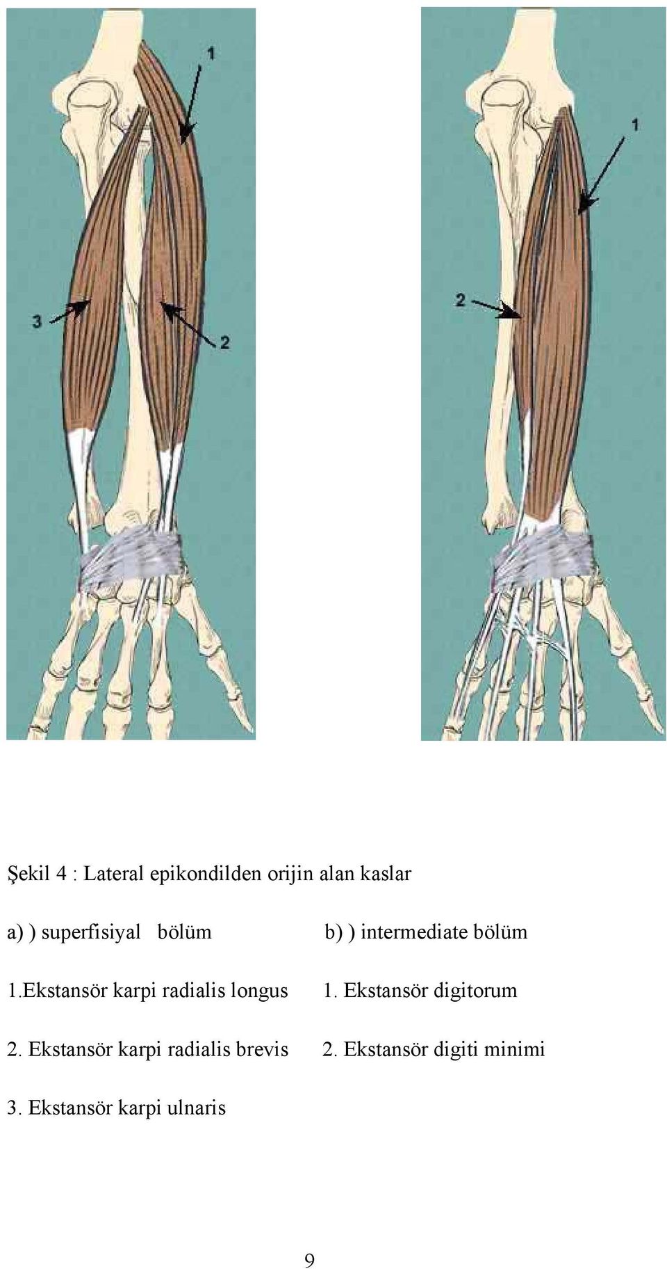 Ekstansör karpi radialis longus 1. Ekstansör digitorum 2.