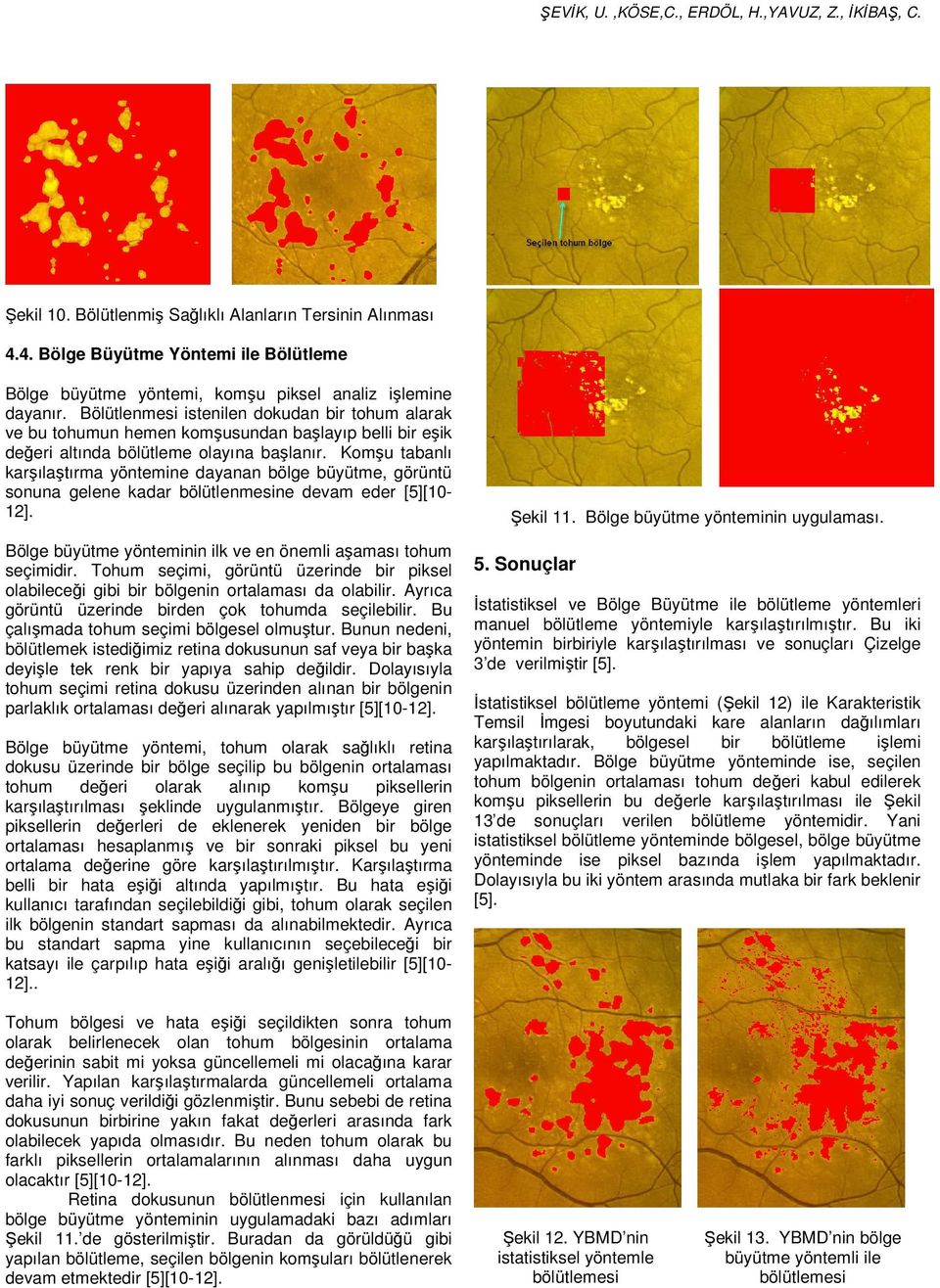 Komşu tabanlı karşılaştırma yöntemine dayanan bölge büyütme, görüntü sonuna gelene kadar bölütlenmesine devam eder [5][10-12]. Bölge büyütme yönteminin ilk ve en önemli aşaması tohum seçimidir.