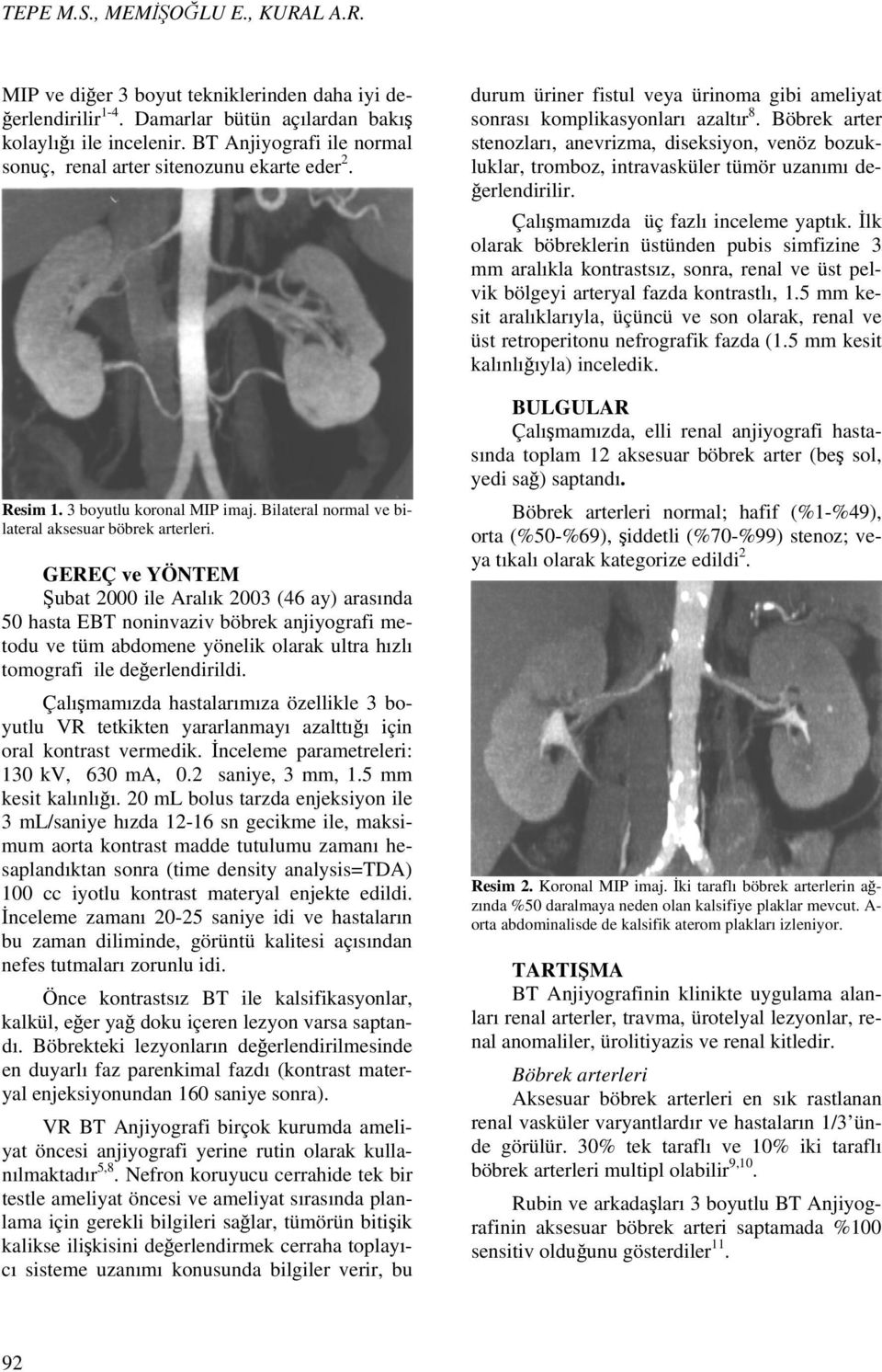 GEREÇ ve YÖNTEM Şubat 2000 ile Aralık 2003 (46 ay) arasında 50 hasta EBT noninvaziv böbrek anjiyografi metodu ve tüm abdomene yönelik olarak ultra hızlı tomografi ile değerlendirildi.