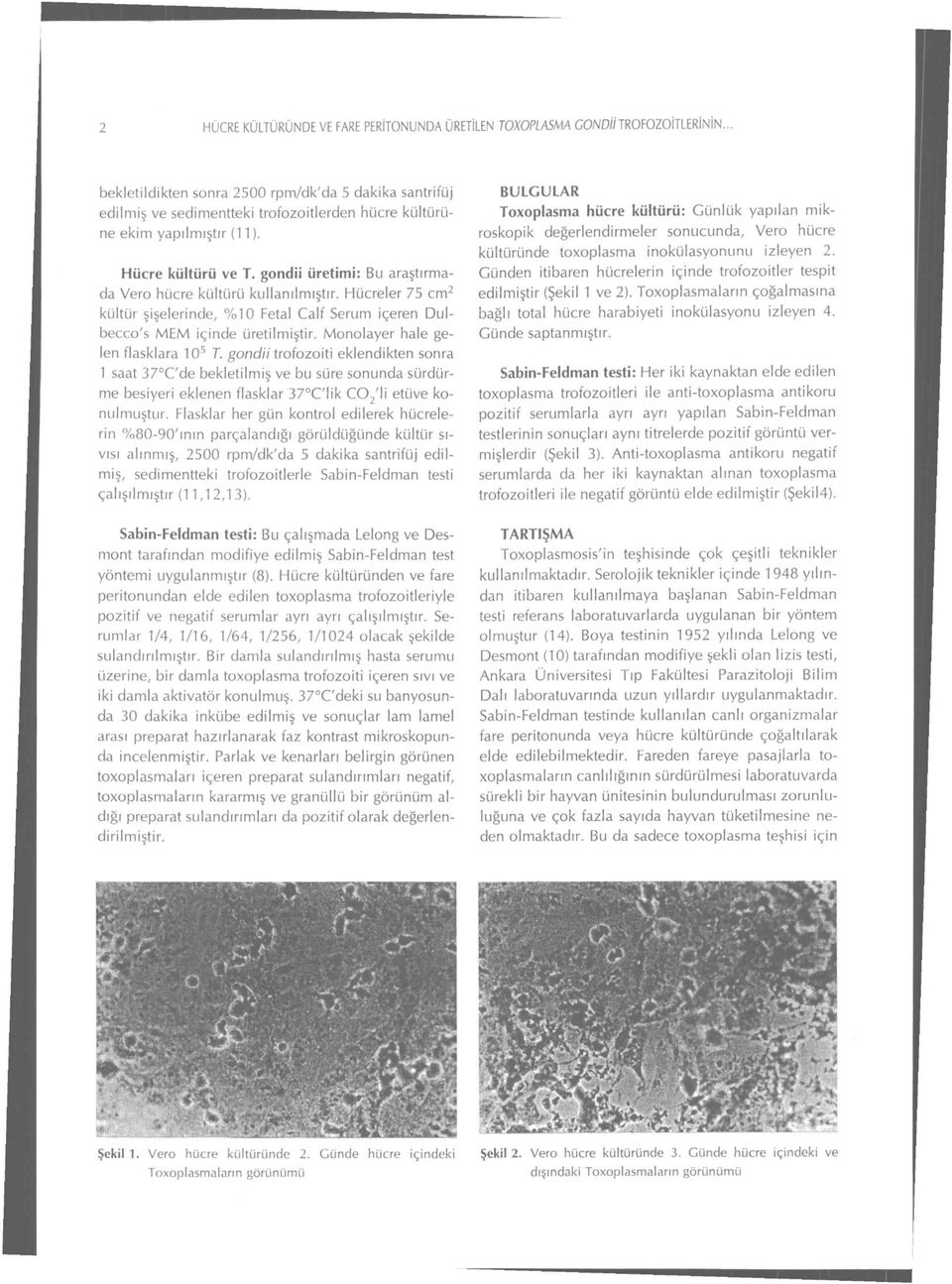 gondii üretimi: Bu araştırmada Vero hiicre kültürü kullanılmıştır. Hücreler 75 cm 2 kültür şişelerinde, %10 Fetal Calf Serum içeren Dulbecco's MEM içinde üretilmiştir.