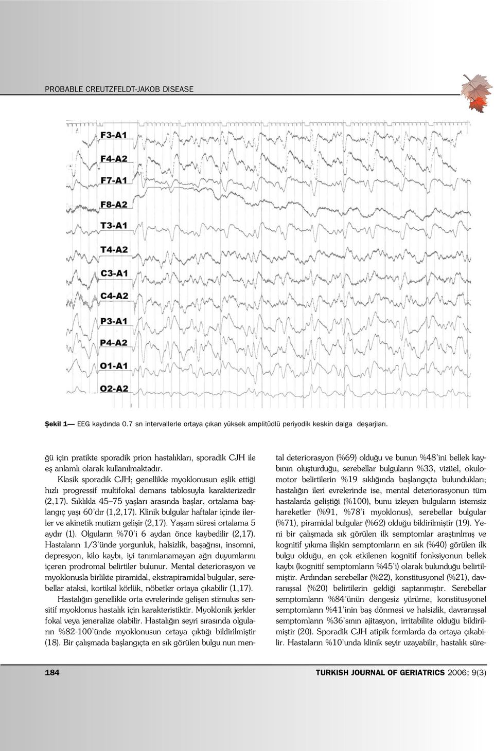 piramidal bulgular (%62) oldu u bildirilmifltir (19).