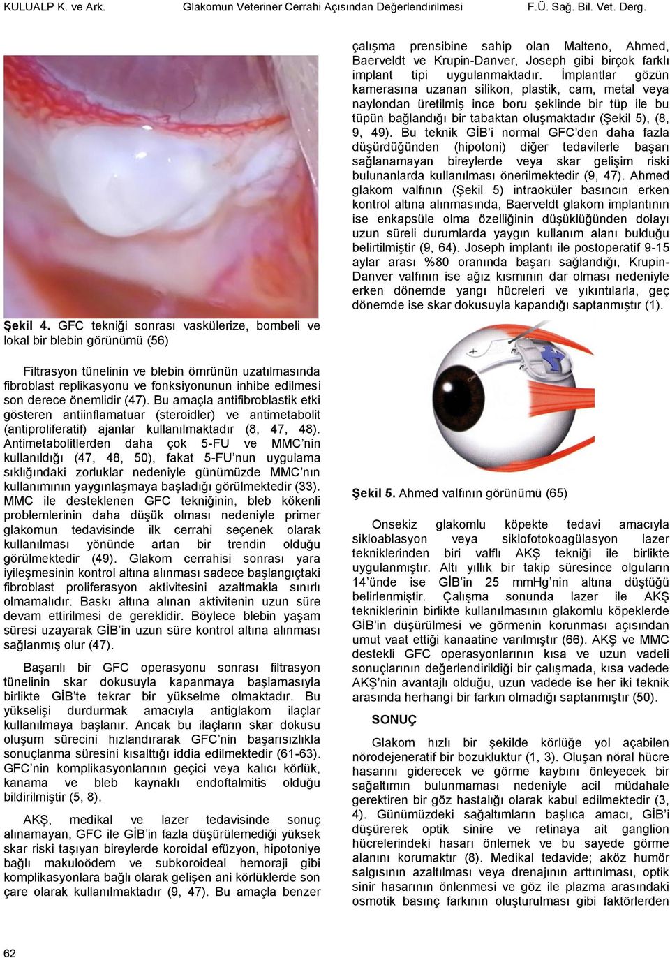 önemlidir (47). Bu amaçla antifibroblastik etki gösteren antiinflamatuar (steroidler) ve antimetabolit (antiproliferatif) ajanlar kullanılmaktadır (8, 47, 48).