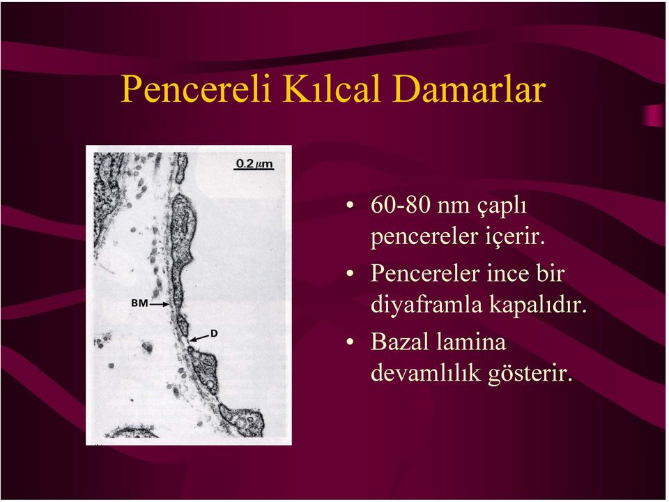 Pencereler ince bir diyaframla