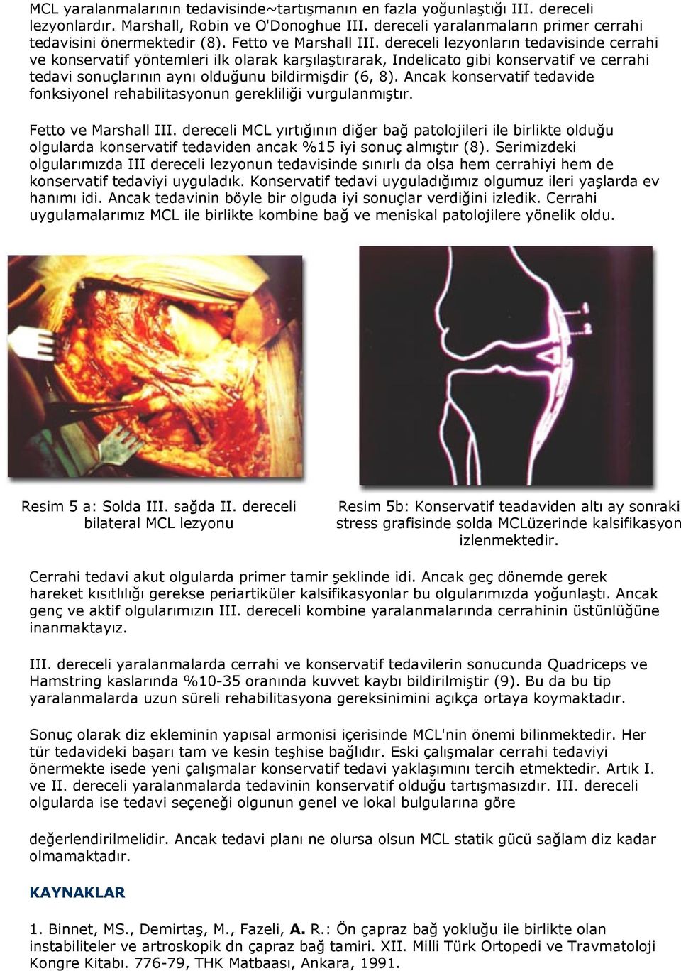 dereceli lezyonların tedavisinde cerrahi ve konservatif yöntemleri ilk olarak karşılaştırarak, Indelicato gibi konservatif ve cerrahi tedavi sonuçlarının aynı olduğunu bildirmişdir (6, 8).