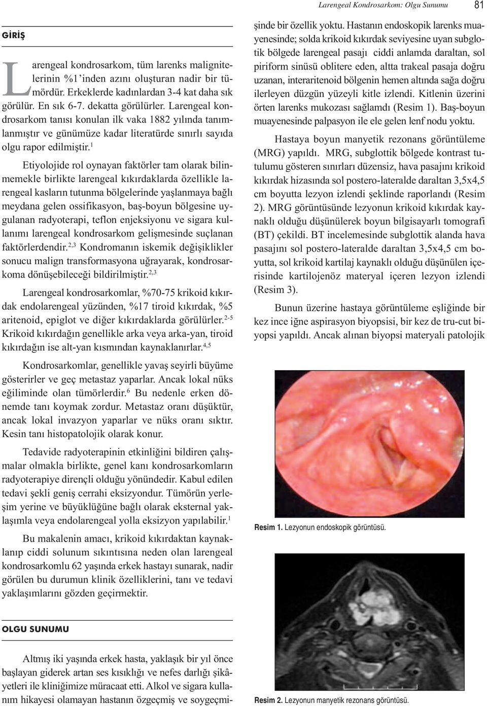 1 Etiyolojide rol oynayan faktörler tam olarak bilinmemekle birlikte larengeal kıkırdaklarda özellikle larengeal kasların tutunma bölgelerinde yaşlanmaya bağlı meydana gelen ossifikasyon, baş-boyun