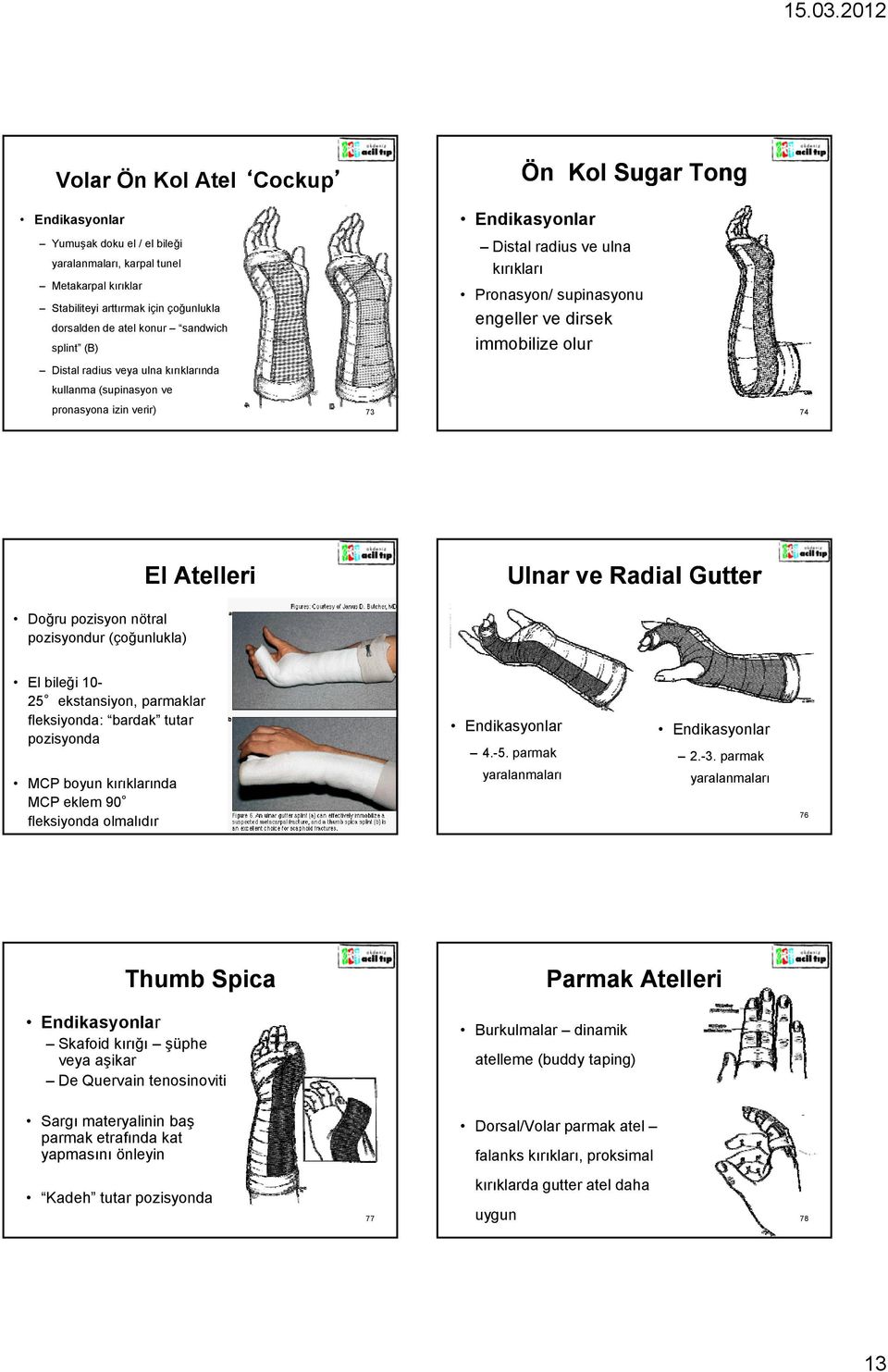 Ulnar ve Radial Gutter Doğru pozisyon nötral pozisyondur (çoğunlukla) El bileği 10-25 ekstansiyon, parmaklar fleksiyonda: bardak tutar pozisyonda MCP boyun kırıklarında MCP eklem 90 fleksiyonda