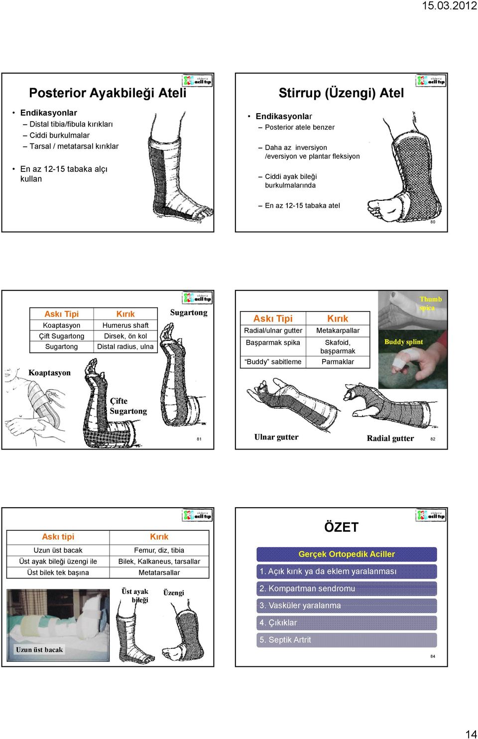 radius, ulna Sugartong Askı Tipi Radial/ulnar gutter Başparmak spika Buddy sabitleme Kırık Metakarpallar Skafoid, başparmak Parmaklar Buddy splint Thumb spica Çifte Sugartong 81 Ulnar gutter Radial