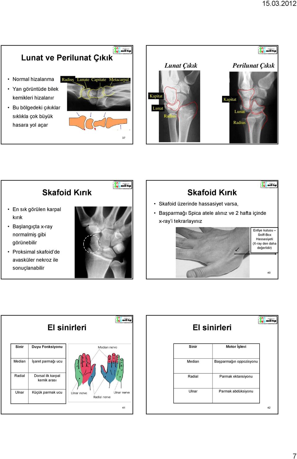 Skafoid Kırık Skafoid üzerinde hassasiyet varsa, Başparmağı Spica atele alınız ve 2 hafta içinde x-ray i tekrarlayınız Enfiye kutusu Sniff-Box Hassasiyeti (X-ray den daha değerlidir) 40 El sinirleri