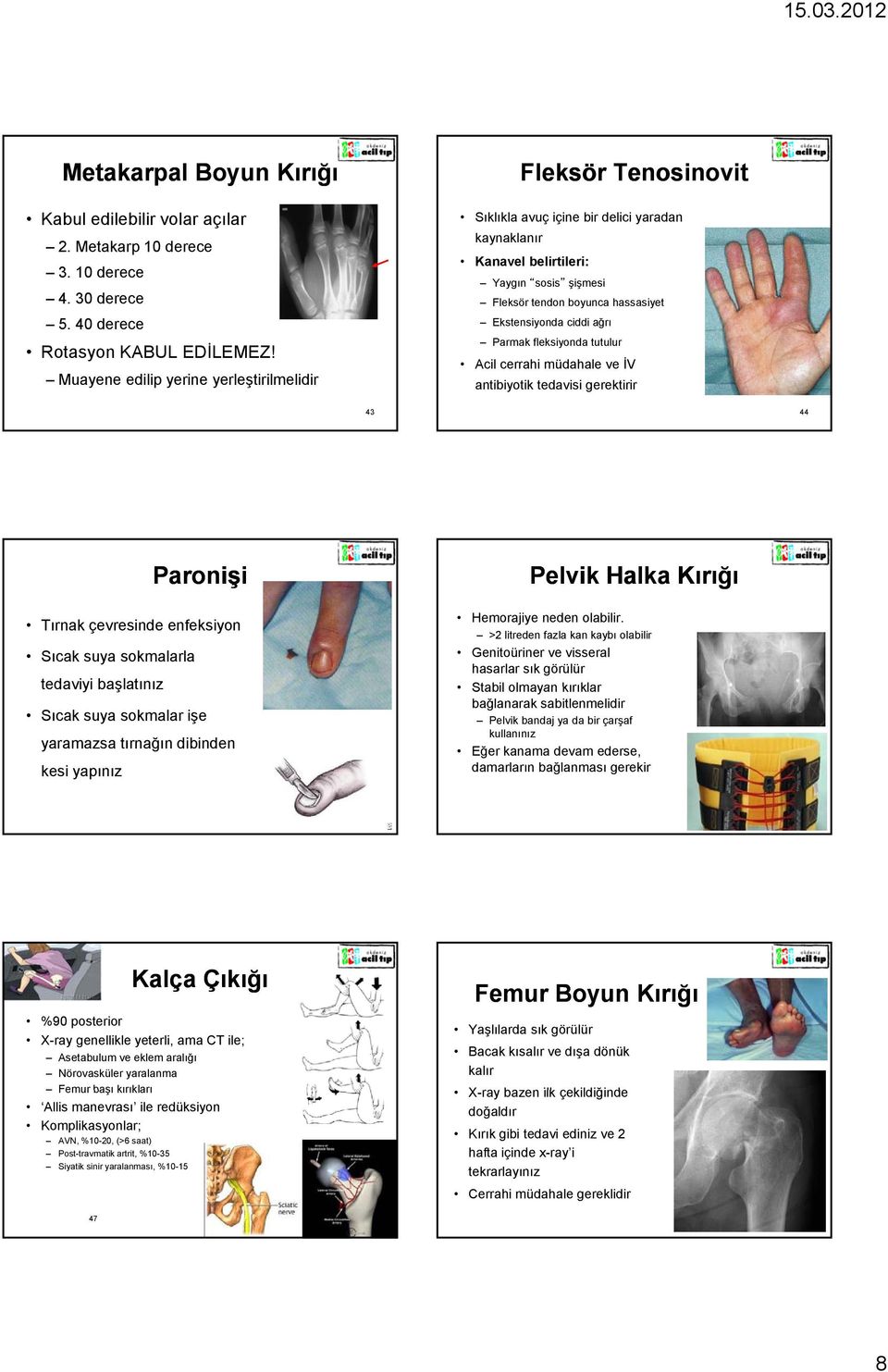 Ekstensiyonda ciddi ağrı Parmak fleksiyonda tutulur Acil cerrahi müdahale ve İV antibiyotik tedavisi gerektirir 43 44 Paronişi Tırnak çevresinde enfeksiyon Sıcak suya sokmalarla tedaviyi başlatınız