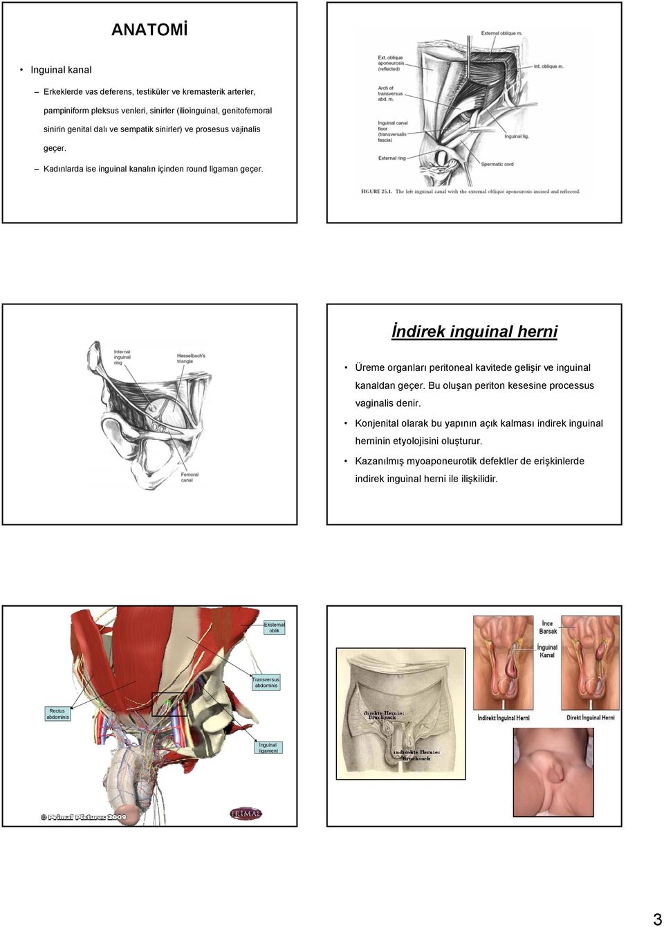 İndirek inguinal herni Üreme organları peritoneal kavitede gelişir ve inguinal kanaldan geçer. Bu oluşan periton kesesine processus vaginalis denir.