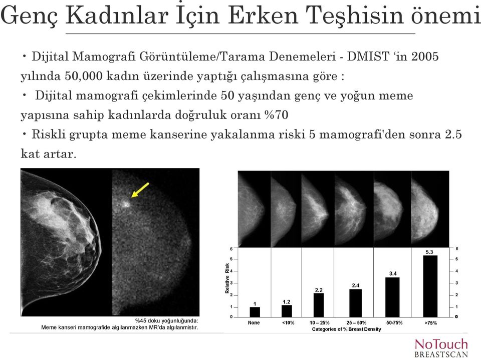 yoğun meme yapısına sahip kadınlarda doğruluk oranı %70 Riskli grupta meme kanserine yakalanma riski 5