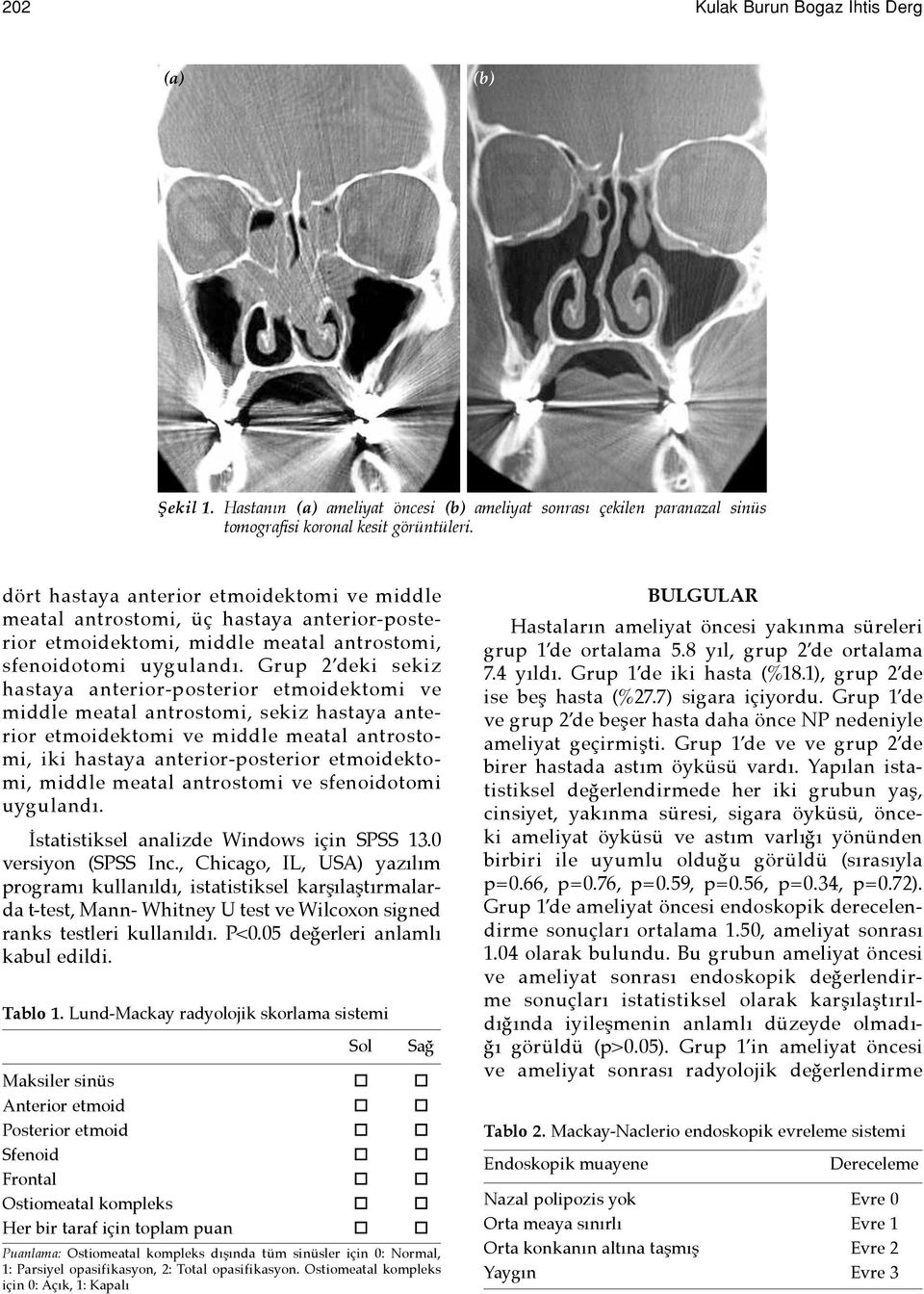 Grup 2 deki sekiz hastaya anterior-posterior etmoidektomi ve middle meatal antrostomi, sekiz hastaya anterior etmoidektomi ve middle meatal antrostomi, iki hastaya anterior-posterior etmoidektomi,