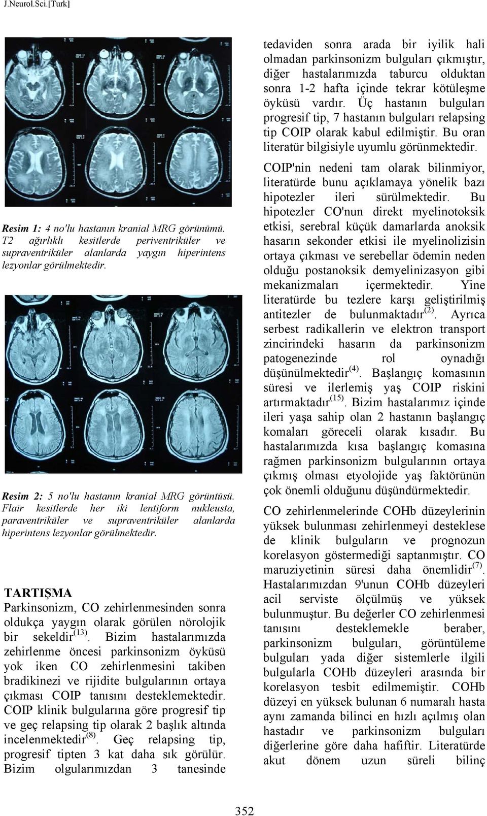 TARTIŞMA Parkinsonizm, CO zehirlenmesinden sonra oldukça yaygın olarak görülen nörolojik bir sekeldir (13).