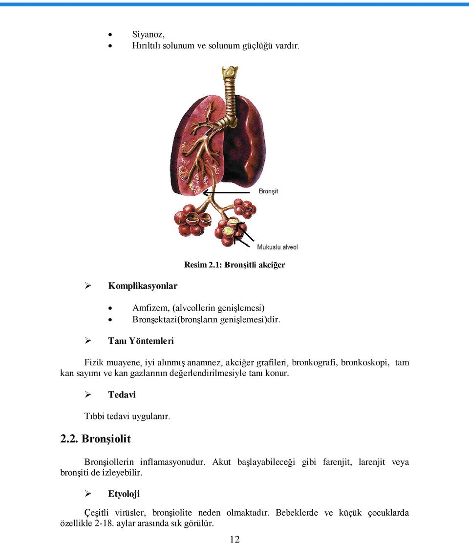 Tanı Yöntemleri Fizik muayene, iyi alınmıģ anamnez, akciğer grafileri, bronkografi, bronkoskopi, tam kan sayımı ve kan gazlarının değerlendirilmesiyle tanı