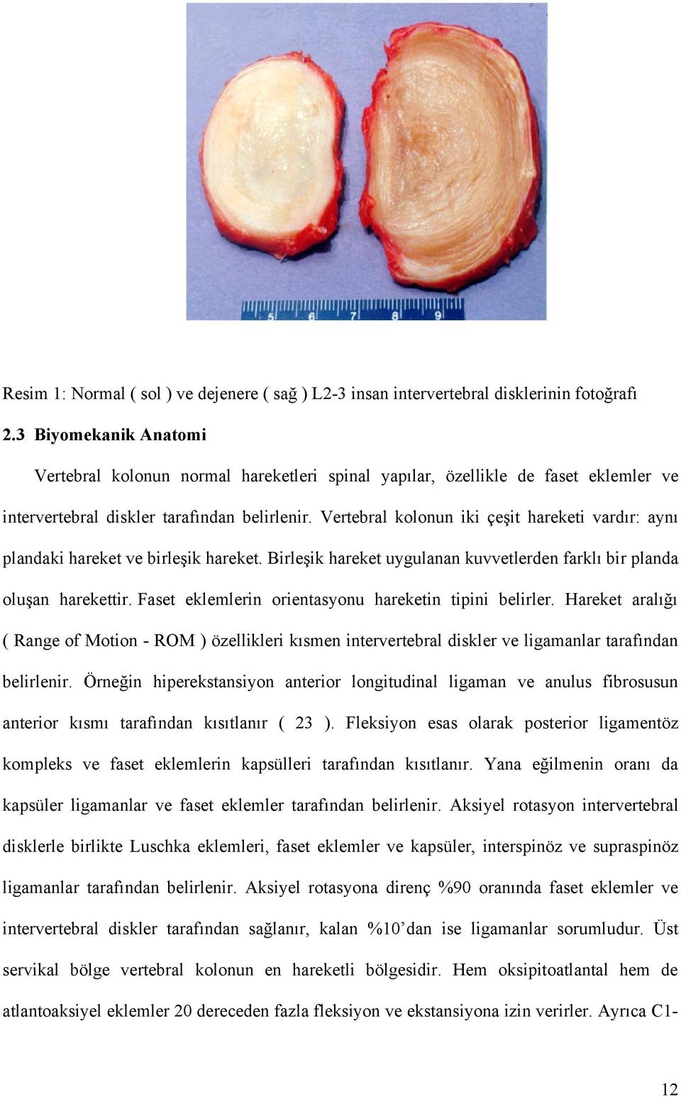 Vertebral kolonun iki çeşit hareketi vardır: aynı plandaki hareket ve birleşik hareket. Birleşik hareket uygulanan kuvvetlerden farklı bir planda oluşan harekettir.