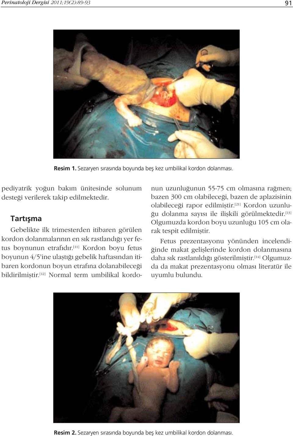 [11] Kordon boyu fetus boyunun 4/5 ine ulaflt gebelik haftas ndan itibaren kordonun boyun etraf na dolanabilece i bildirilmifltir.