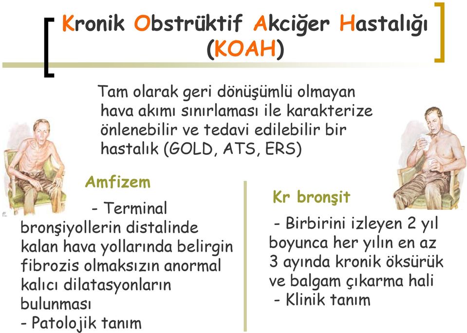 distalinde kalan hava yollarında belirgin fibrozis olmaksızın anormal kalıcı dilatasyonların bulunması -