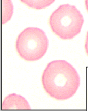 Normal eritrosit Bikonkav, disk, kase
