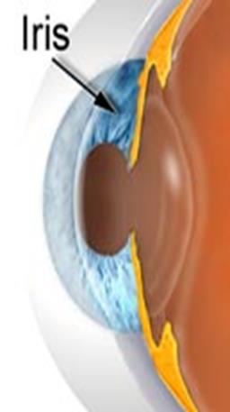 İRİS-Pupilla Pupillanın çapı 1-8 mm arasında değişir. Normal insanların yaklaşık %25 inde hafif bir anizokori olması normaldir.