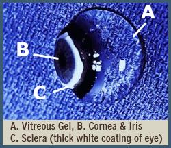 VİTREUS Işığı kıran yapıların en büyük hacimlisidir. Ön tarafta bir çöküntü yapar ve lens in yerleştiği çukurluğa lentiküler fossa (fossa hyaloidea) denir.