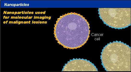 Manyetik Nanoparçacıklar ile Kanserli Hücreler Daha kolay