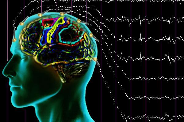 Yararlı ancak acil servisten ulaşılması zor İnatçı ve açıklanamayan bilinç değişikliği olan hastalarda nonkonvülzif status epileptikusu tespit etmek için(eeg de