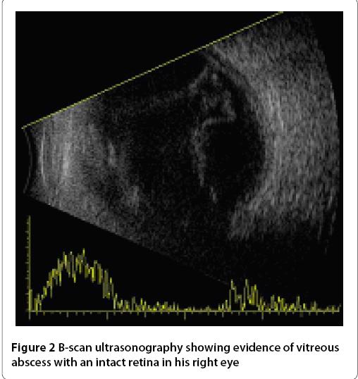 B-Scan (Brightness scan) Muzahila