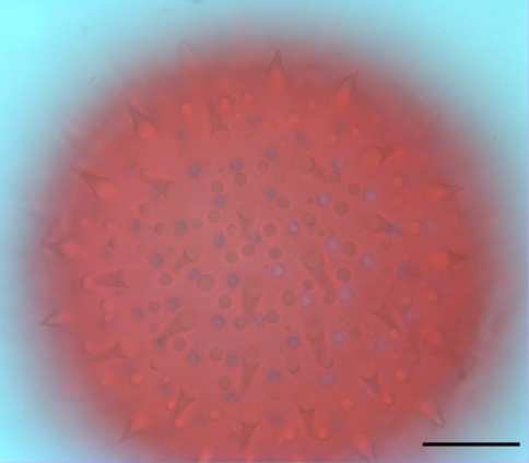 2008), polen mikrofotoğrafları şekil 4.93 te verilmiştir.