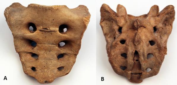 Osteoloji Genel Bilgiler ve Vücut Kemikleri Vertebrae thoracica: Göğüs bölgesini oluştururlar. Sayıları on iki (12) tanedir. Kaburgalarla eklem yaparlar (Şekil 5A).