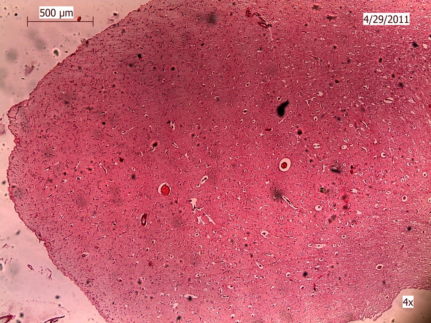 Beyincik Beyincik (Cerebellum), vücudun denge organlarından biridir.