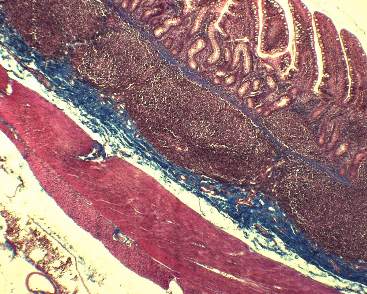 hariç bütün lenfoid organlar lenf folikülüne sahiptir