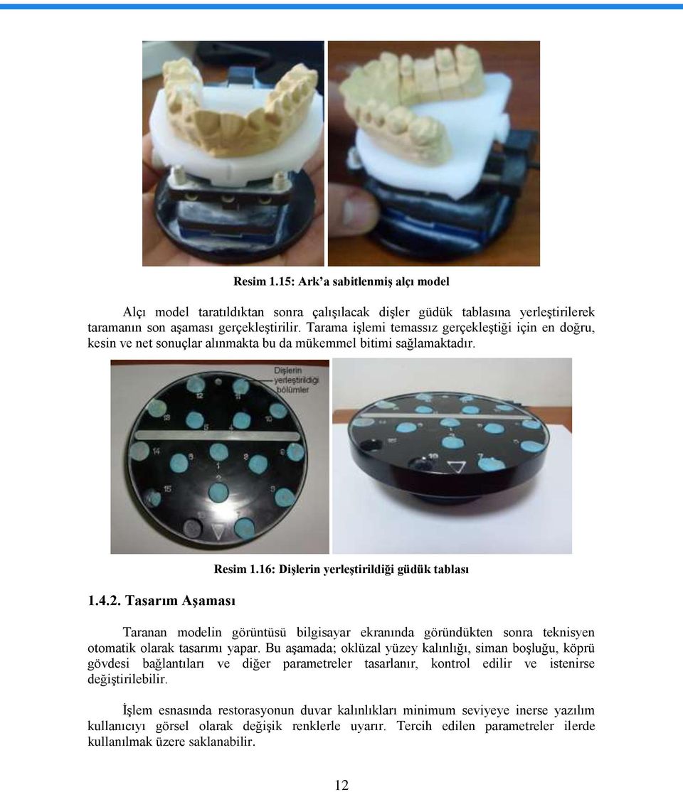 16: DiĢlerin yerleģtirildiği güdük tablası Taranan modelin görüntüsü bilgisayar ekranında göründükten sonra teknisyen otomatik olarak tasarımı yapar.