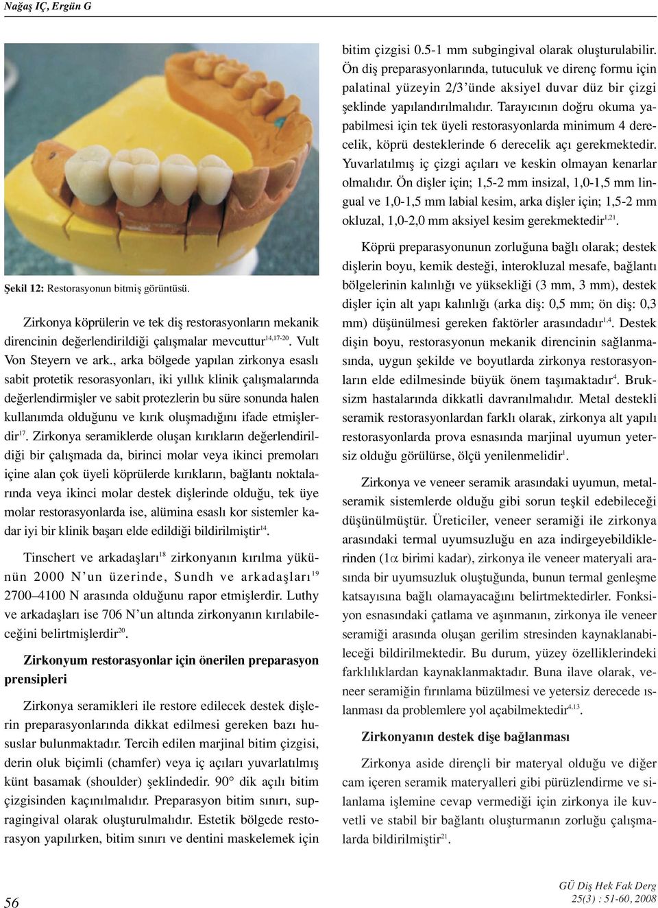 Taray c n n do ru okuma yapabilmesi için tek üyeli restorasyonlarda minimum 4 derecelik, köprü desteklerinde 6 derecelik aç gerekmektedir.