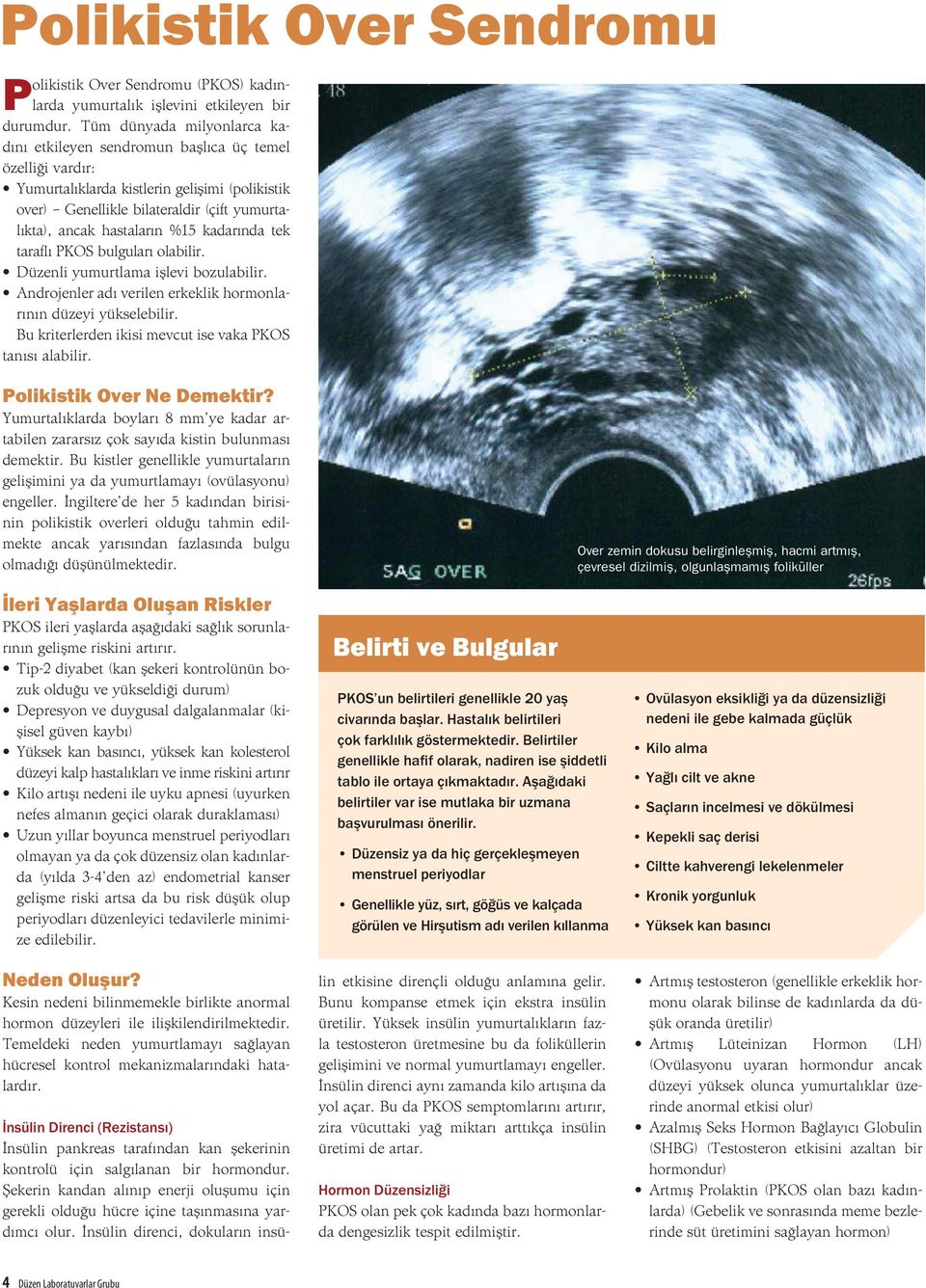 %15 kadarında tek taraflı PKOS bulguları olabilir. Düzenli yumurtlama işlevi bozulabilir. Androjenler adı verilen erkeklik hormonlarının düzeyi yükselebilir.