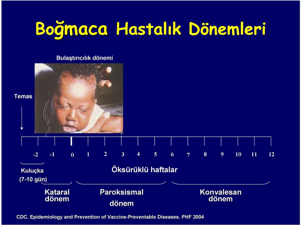 gün) g Kataral dönem Öksürüklü haftalar Paroksismal dönem Konvalesan