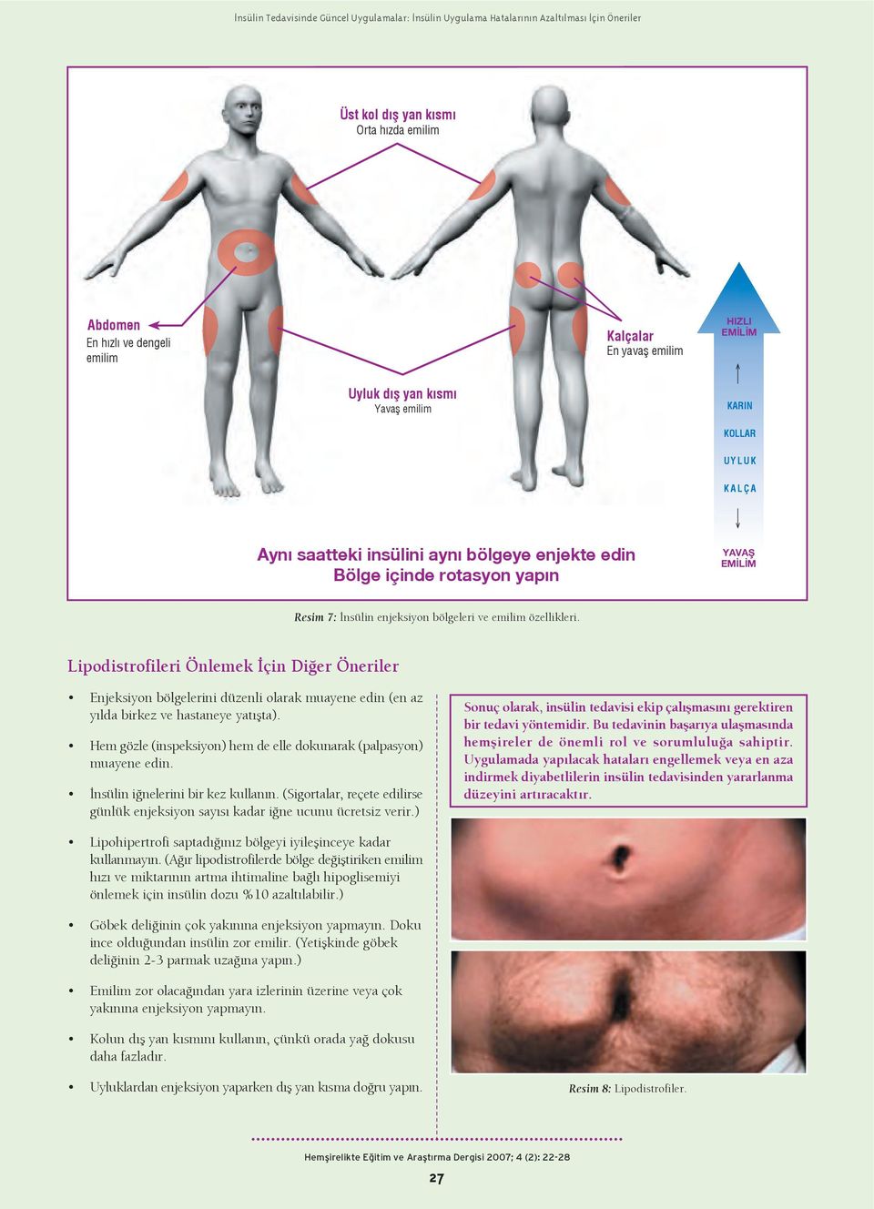 özellikleri. Lipodistrofileri Önlemek çin Di er Öneriler Enjeksiyon bölgelerini düzenli olarak muayene edin (en az y lda birkez ve hastaneye yat flta).